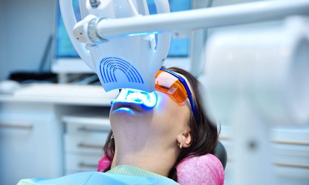 What Is Chairside Teeth Whitening?