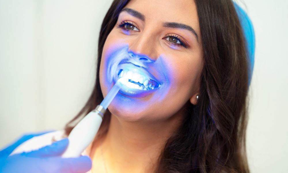 Understanding Different Types of Teeth Whitening Treatments Available in Brisbane City