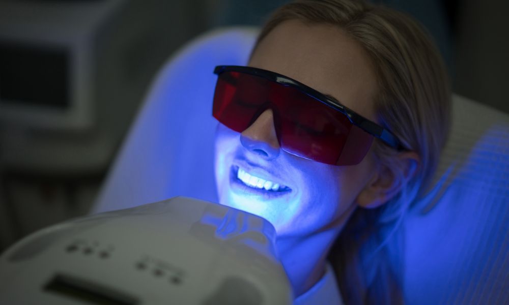 Why Brisbane Residents Are Choosing Professional Teeth Whitening