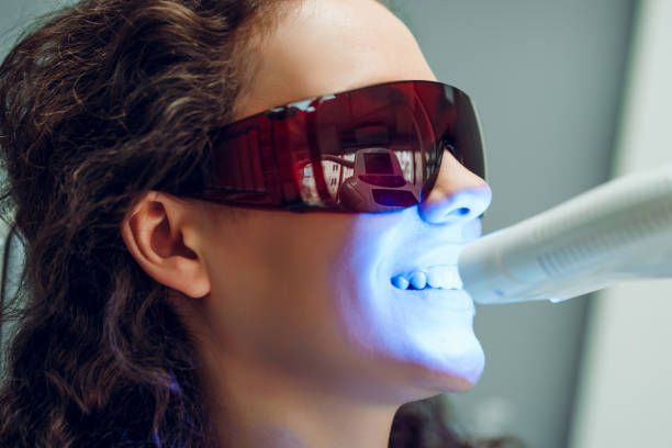 What to Expect During Your Teeth Whitening Appointment in Brisbane