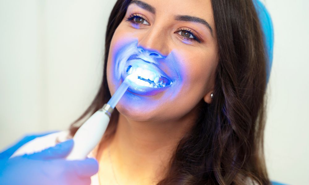 Teeth Whitening Treatments in Brisbane: Is It Worth the Investment?