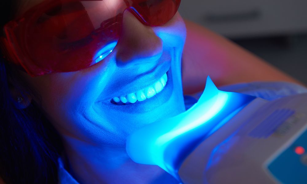 5 Amazing Benefits of Laser Teeth Whitening Treatment